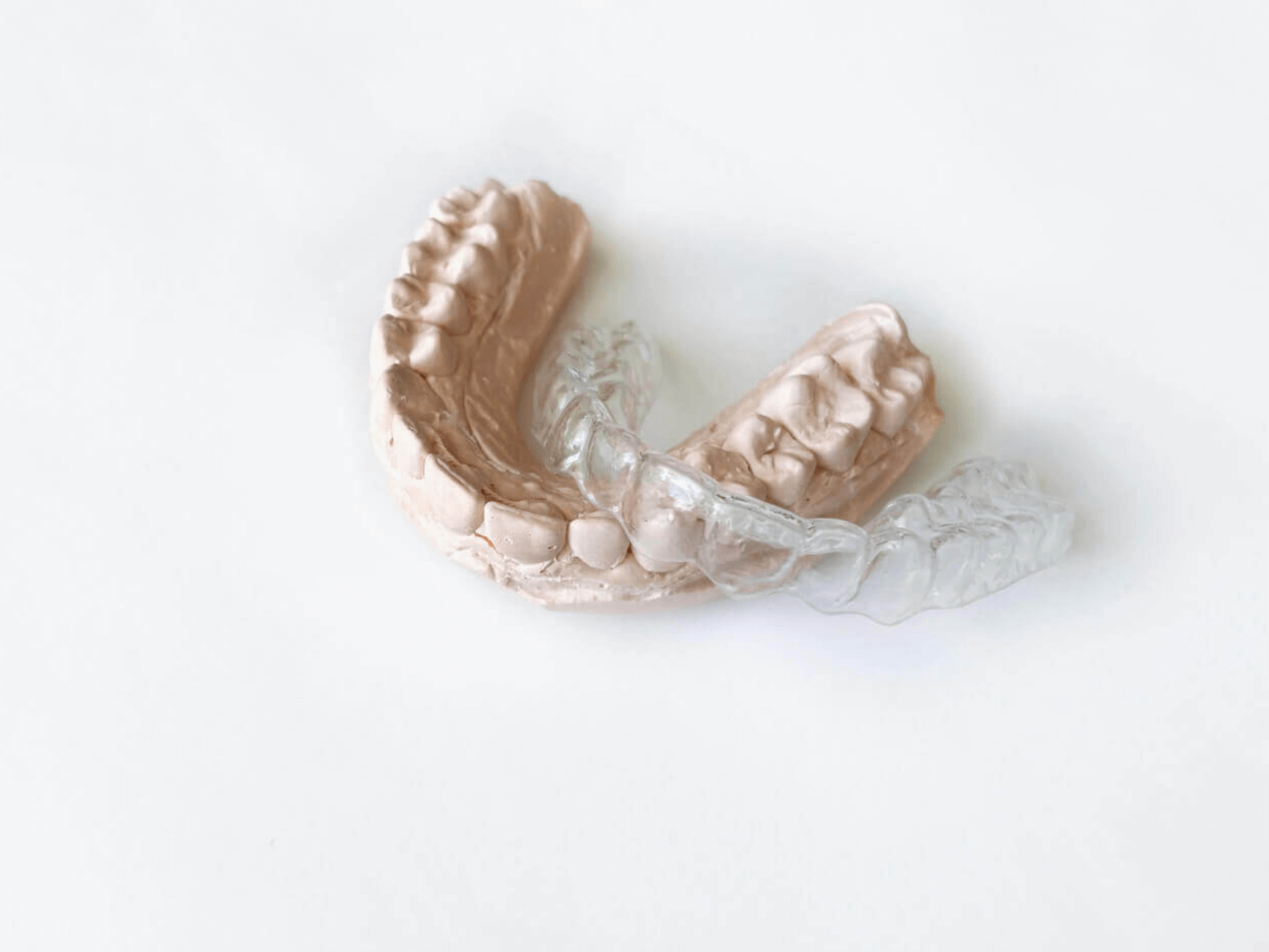 マウスピース矯正