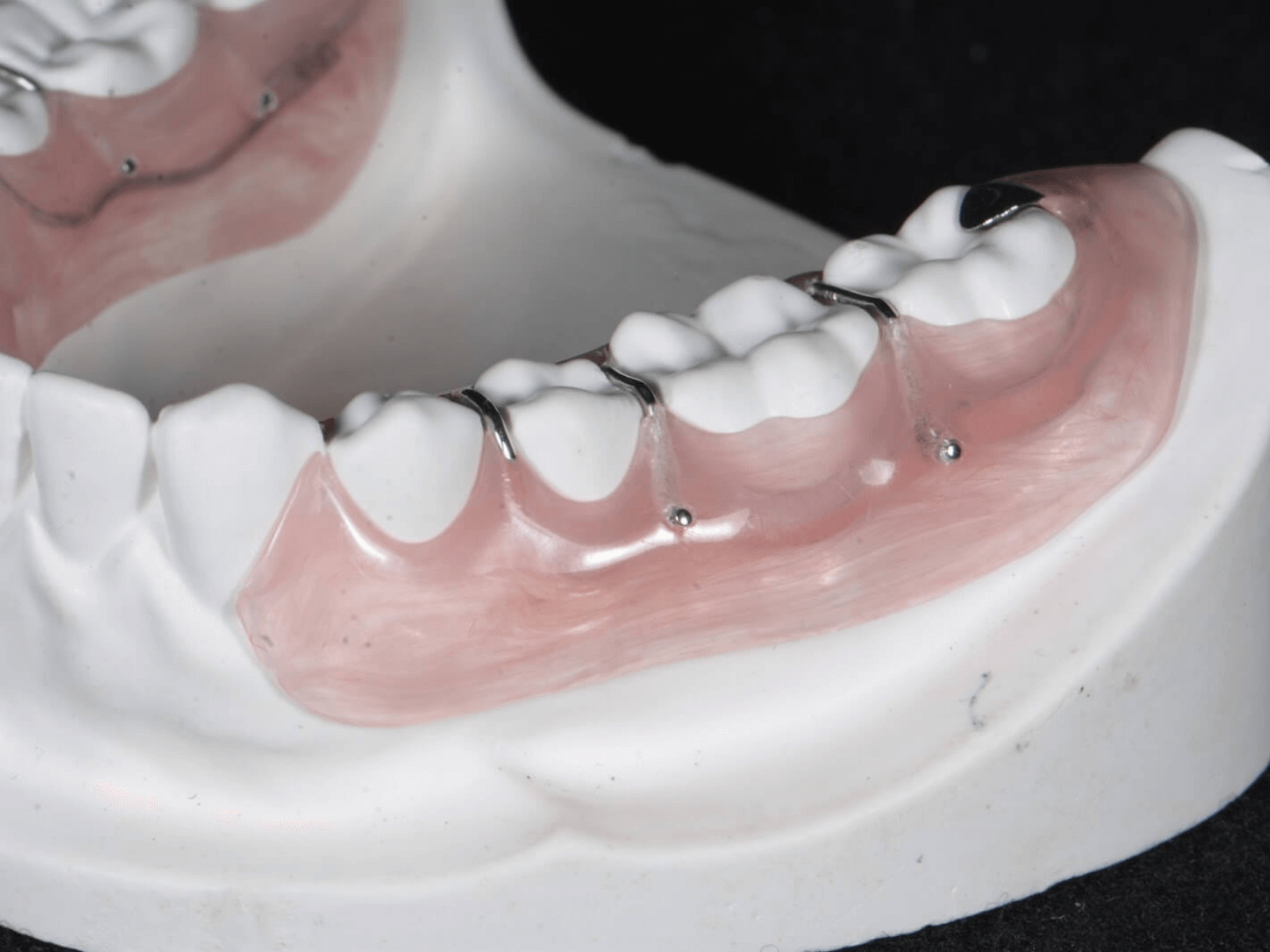 ペリオスプリント1