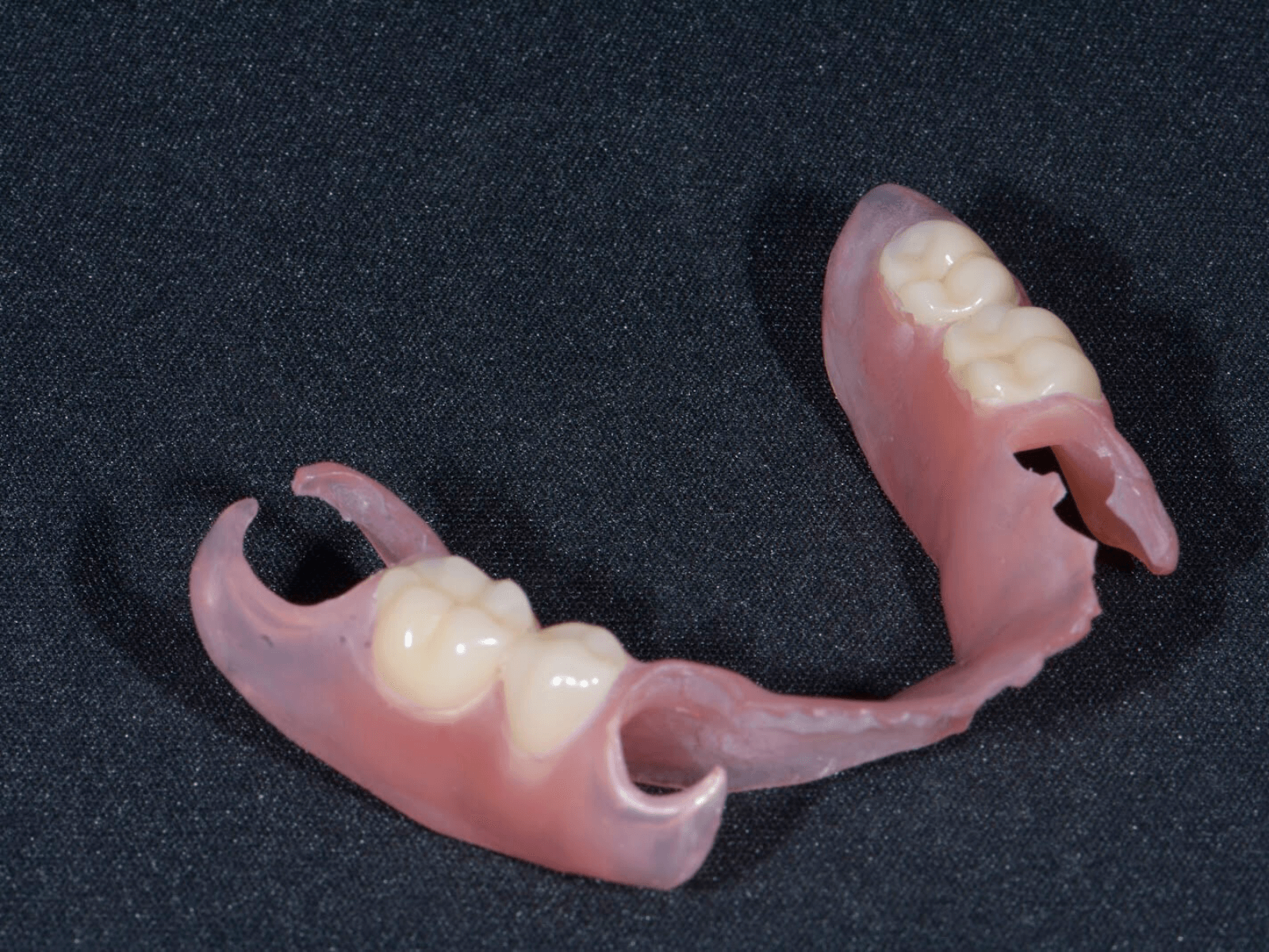 ノンクラスプデンチャー2