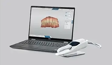 口腔内スキャナー