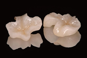 精密な歯科技工物