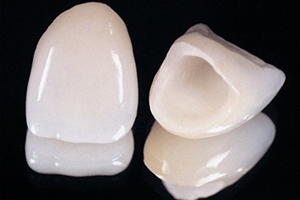 精密な歯科技工物